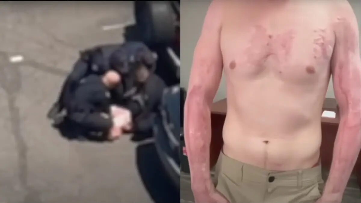 ‘His Skin Was Cooked on Asphalt’: Phoenix Man Who Suffered Severe Burns After Cops Pinned Him On Hot Pavement In 114-Degree Weather for Over 4 Minutes Takes Legal Action